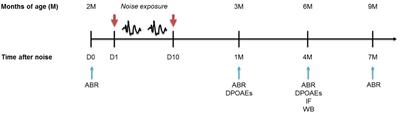 Early Noise-Induced Hearing Loss Accelerates Presbycusis Altering Aging Processes in the Cochlea